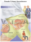 Female Urinary Incontinence - Anatomical Chart